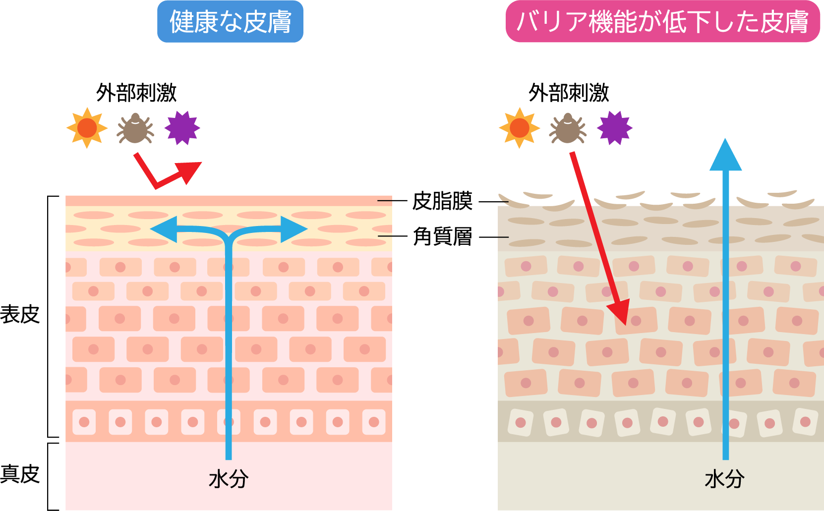 健康な肌と、バリア機能が低下した肌のイラスト