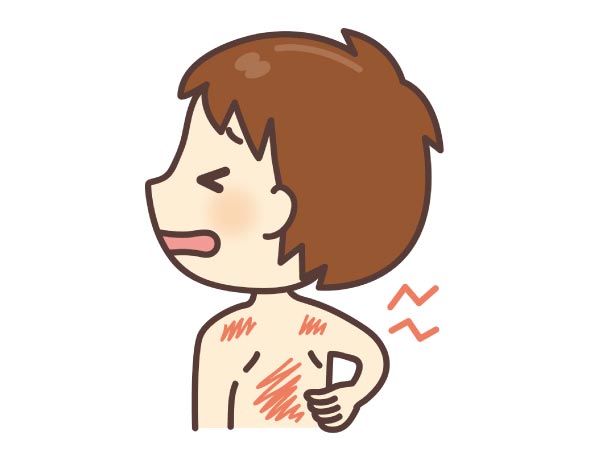 背中をかきむしる子のイラスト