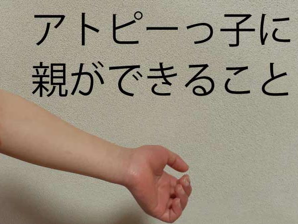 アトピーの子供の手