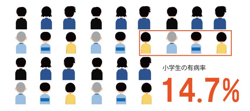 小学生の14.7％はアトピー