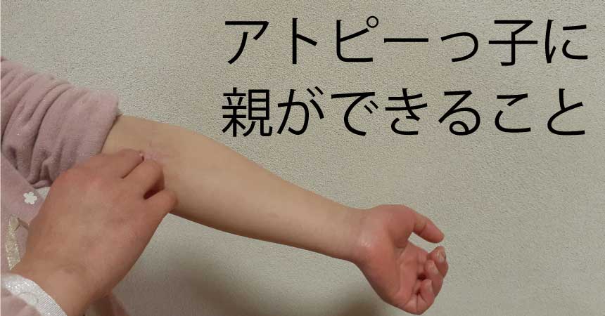 アトピーっ子に親ができること