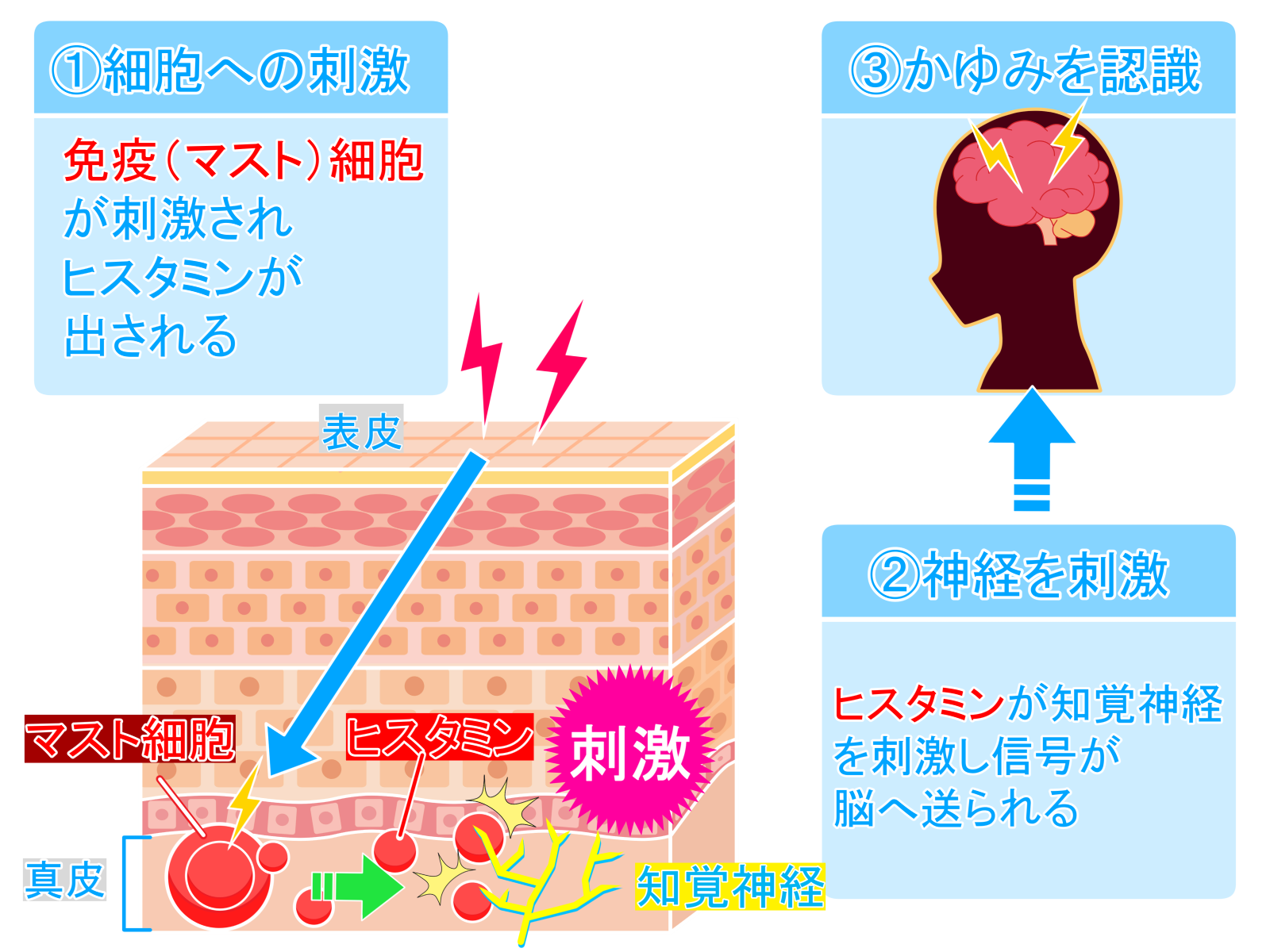 かゆみの発生メカニズムを説明する図