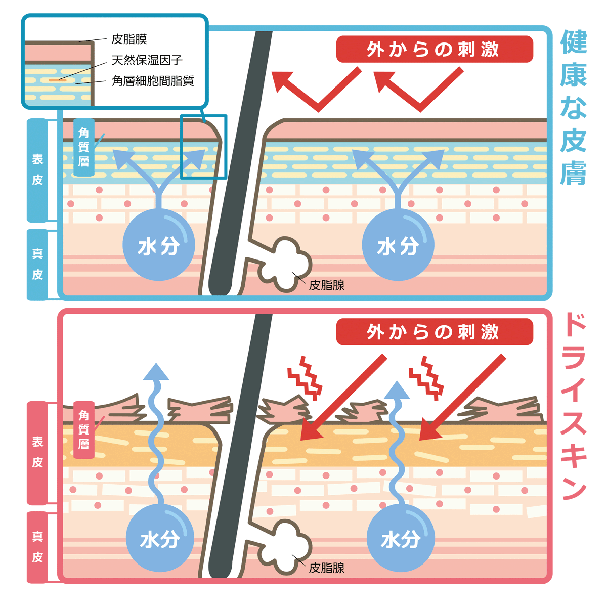ドライスキンの概念図