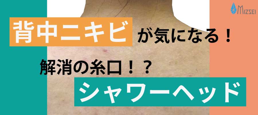 背中ニキビが気になる！解決の糸口はシャワーヘッド？！