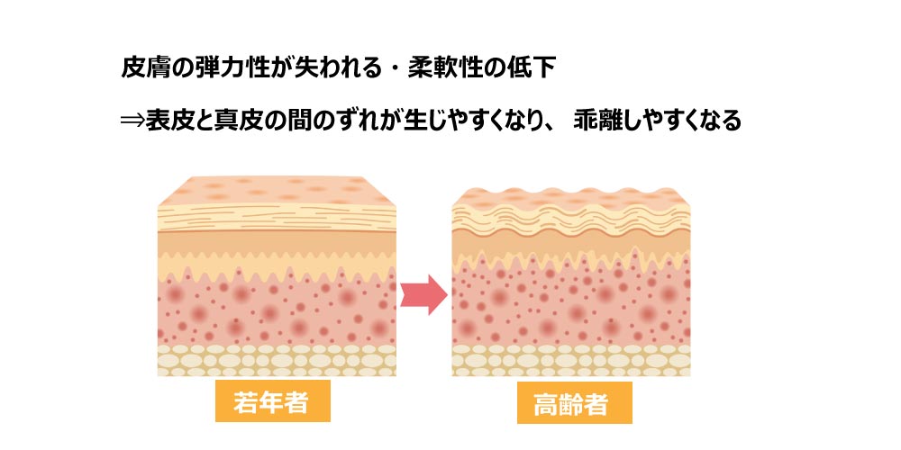 高齢者の皮膚の特徴