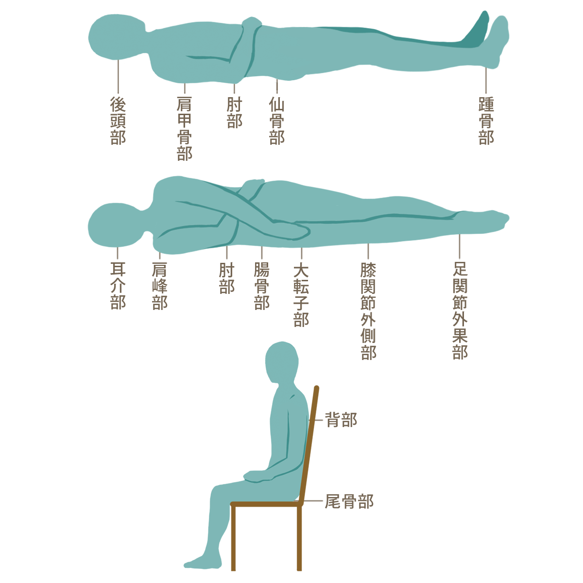 床ずれが起きやすい場所を説明するイラスト