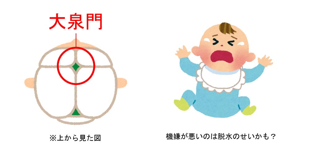 乳幼児の脱水の説明